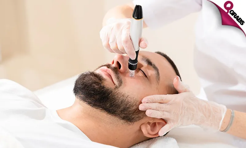 Dermapen, Mesotherapy & PRP for Men!